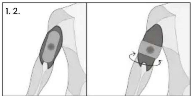 TensCare Form - Tríceps - 15
