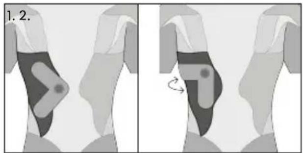TensCare Form - Tríceps - 7