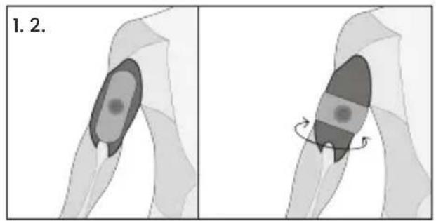 TensCare Form - Dépannage - 1