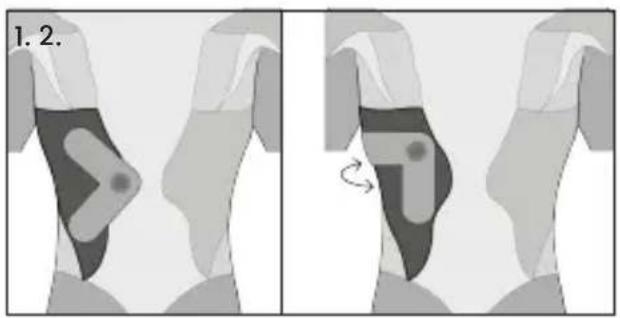 TensCare Form - Tríceps - 21
