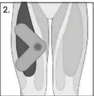 TensCare Form - Dépannage - 11