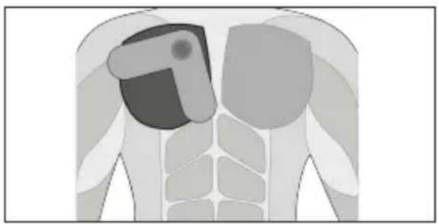 TensCare Form - Dépannage - 7