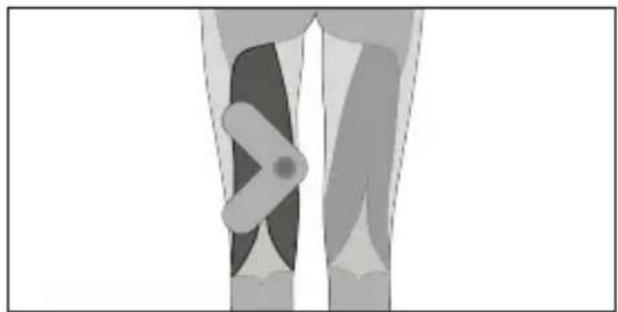 TensCare Form - Dépannage - 12