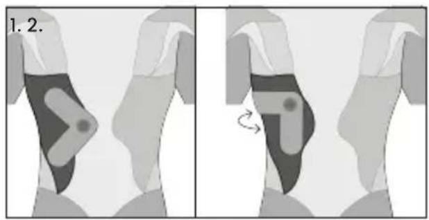 TensCare Form - Dépannage - 6