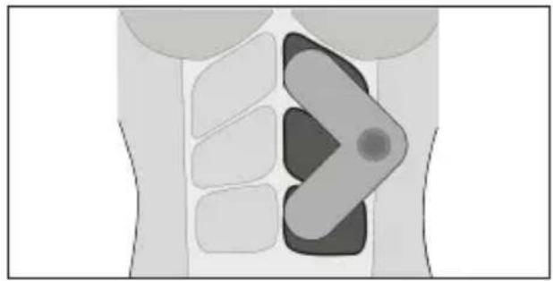 TensCare Form - Dépannage - 8