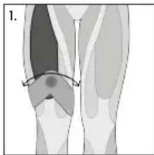 TensCare Form - Dépannage - 10