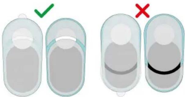 TensCare Ova 3 - Applying the hydrogels - 3