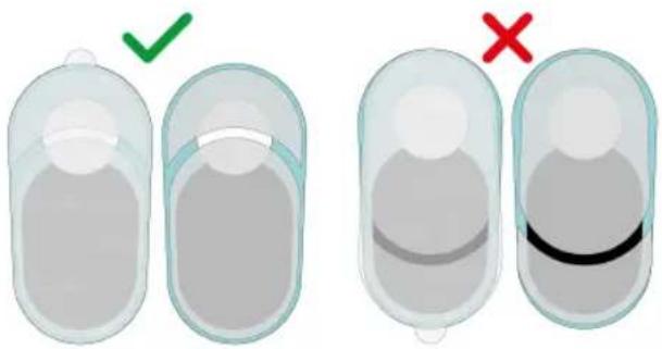TensCare Ova 3 - Application des électrodes - 1