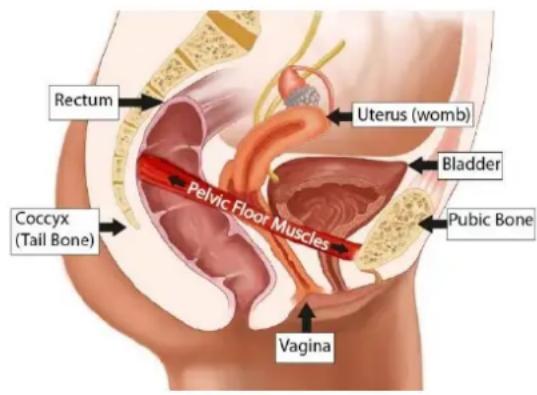 TensCare Sure PRO - PELVIC FLOOR MUSCLES - 2