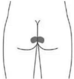 TensCare Sure PRO - Placement facultatif d'électrodes à la surface de la peau pour URGE (cette méthode peut ne pas être aussi efficace que la stimulation avec la sonde vaginale). - 2