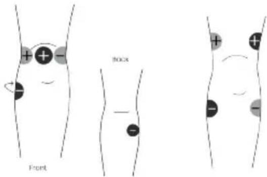TensCare Unipro - Kontraindikationen - 9