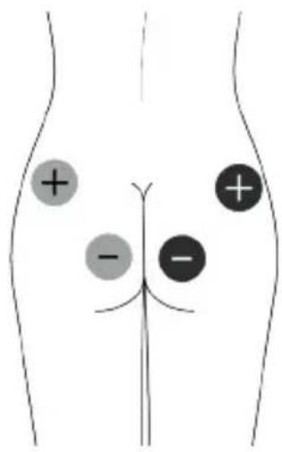 TensCare Unipro - EMS Pad Placement - 7
