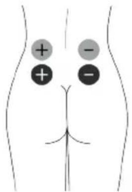 TensCare Unipro - Posizionamento del pad IFT4 - 3