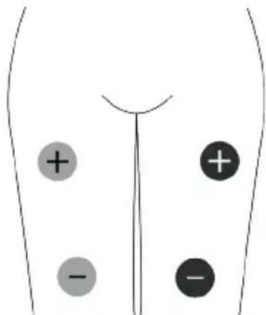 TensCare Unipro - EMS Pad Placement - 9