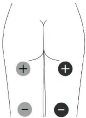 TensCare Unipro - EMC - 10