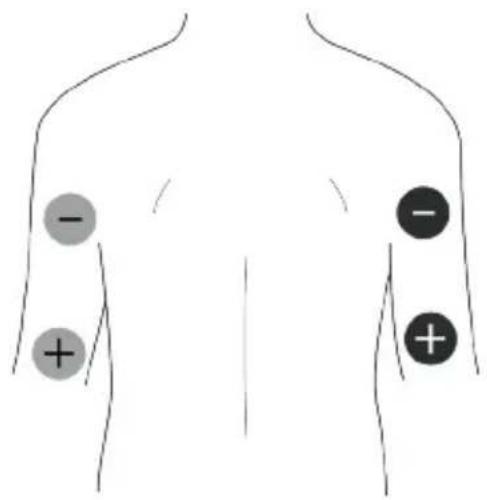 TensCare Unipro - EMS Pad Placement - 2