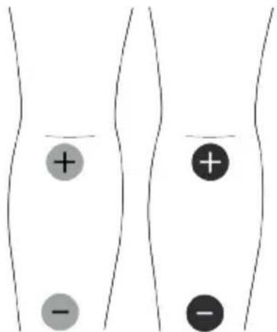 TensCare Unipro - EMC - 12