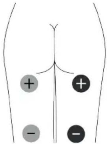 TensCare Unipro - Kontraindikationen - 8