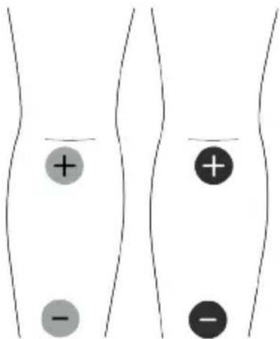 TensCare Unipro - EMS Pad Placement - 10