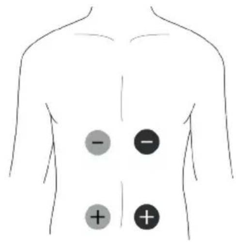 TensCare Unipro - EMS Pad Placement - 3