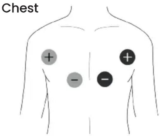 TensCare Unipro - EMS Pad Placement - 1