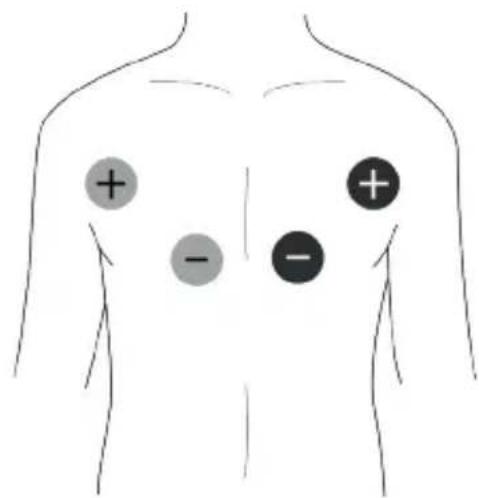 TensCare Unipro - Posizionamento del pad EMS - 2