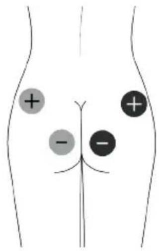 TensCare Unipro - Kontraindikationen - 6