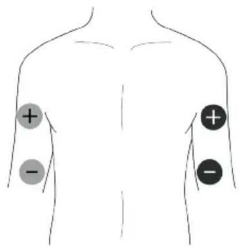TensCare Unipro - EMS-Pad Platzierung - 2