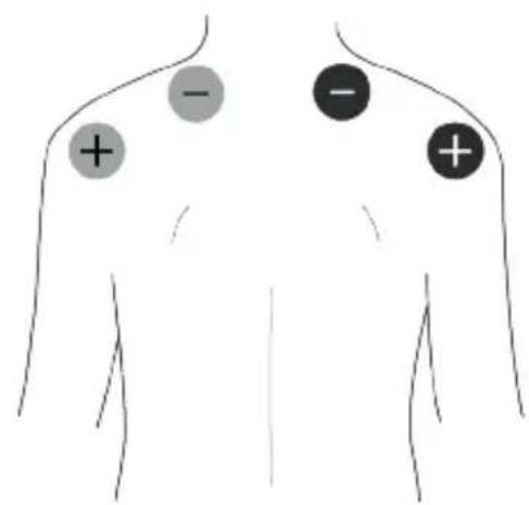 TensCare Unipro - EMS-Pad Platzierung - 3