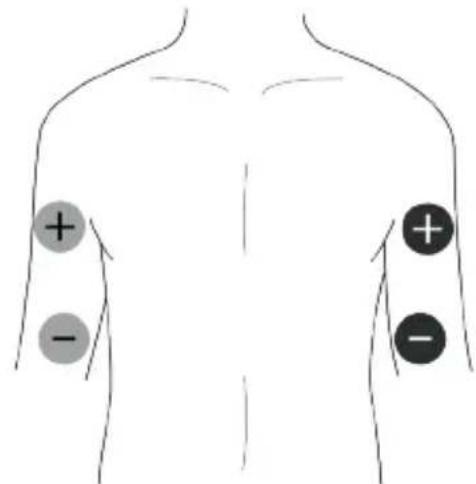 TensCare Unipro - Colocación de los electrodos EMS - 2