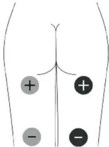 TensCare Unipro - EMS Pad Placement - 8
