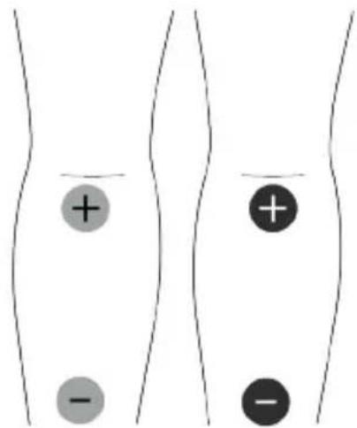 TensCare Unipro - EMC - 13