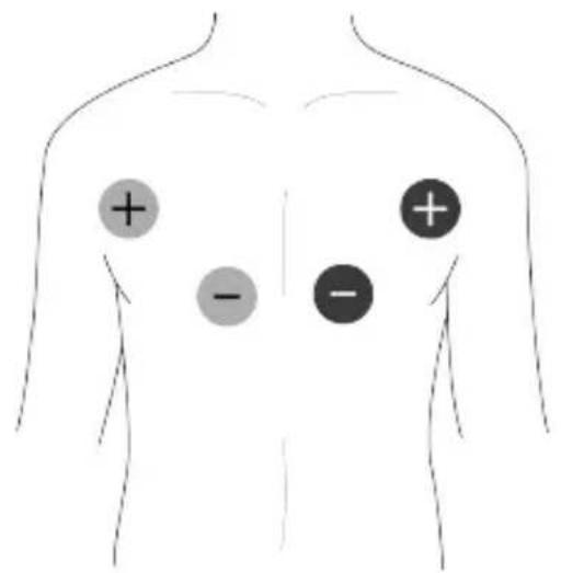 TensCare Unifit - EMC - 5