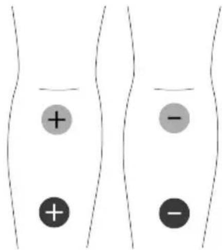 TensCare Unifit - Colocación de los electrodos masaje - 3