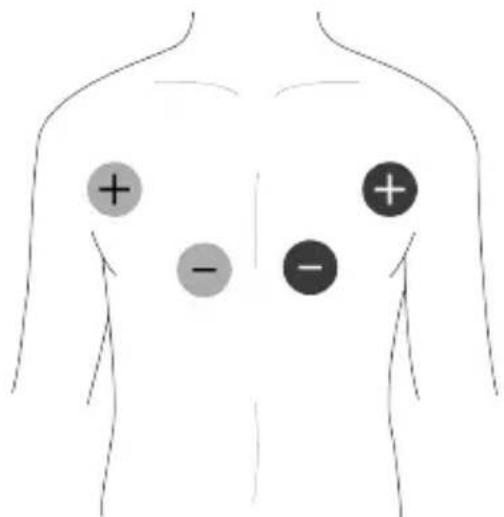 TensCare Unifit - Placement des électrodes EMS - 2
