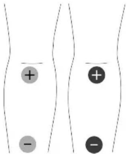 TensCare Unifit - EMC - 11