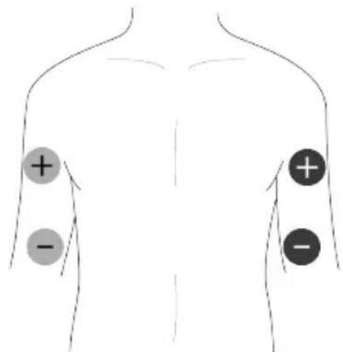 TensCare Unifit - Posizionamento del pad EMS - 2
