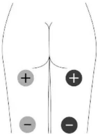 TensCare Unifit - EMC - 13