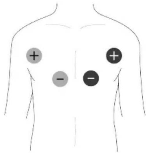 TensCare Unifit - EMC - 5