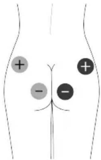 TensCare Unifit - EMC - 11