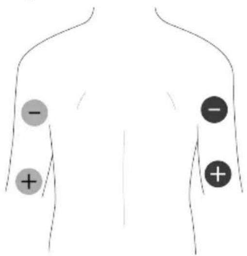 TensCare Unifit - EMS Pad Placement - 4