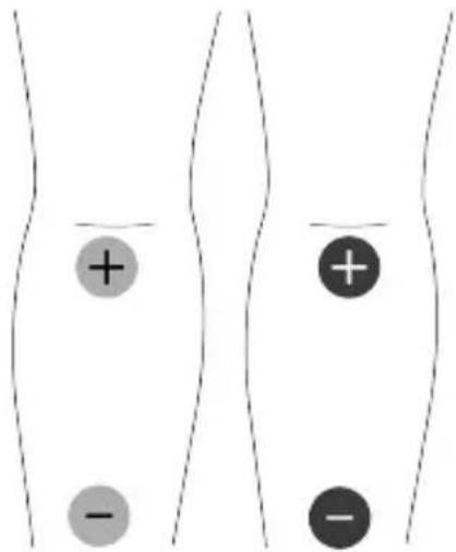 TensCare Unifit - EMC - 11