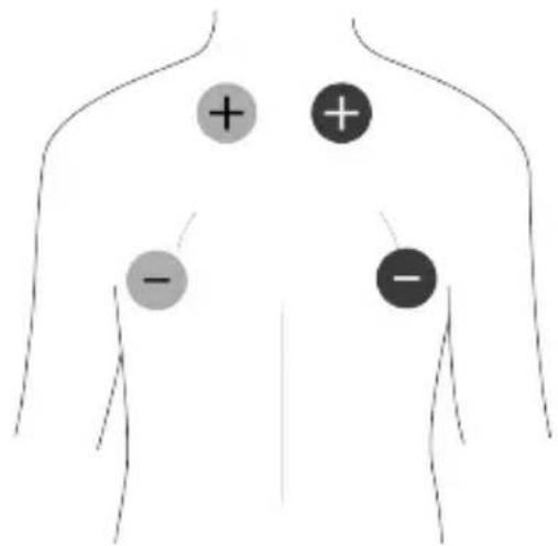 TensCare Unifit - LA GARANTIA ES NULA MENOS QUE LA INFORMACION ANTERIOR SEA COMPLETA Y CORRECTA - 1