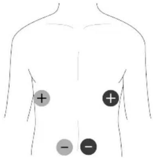TensCare Unifit - EMS Pad Placement - 7