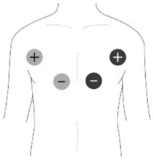 TensCare Unifit - Colocación de los electrodos EMS - 2