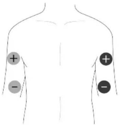 TensCare Unifit - EMS Pad Placement - 6