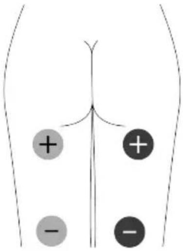 TensCare Unifit - WARRANTY IS VOID UNLESS THE ABOVE INFORMATION IS COMPLETED AND CORRECT - 11