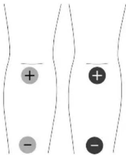 TensCare Unifit - EMC - 12