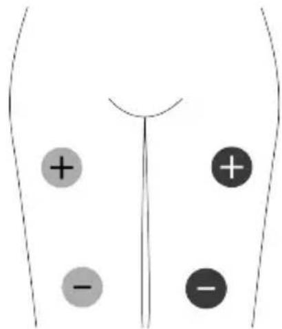 TensCare Unifit - EMC - 10