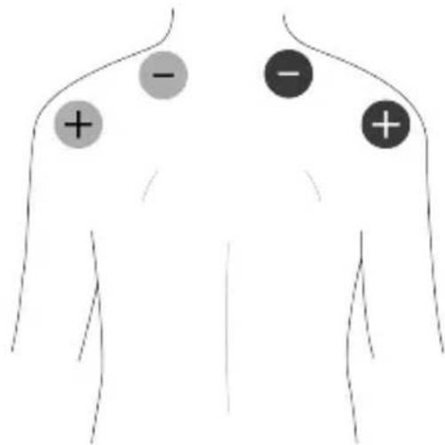 TensCare Unifit - Schultern und oberer Rücken - 1